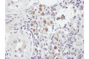 Immunohistochemistry (IHC) image for anti-MutS Homolog 6 (E. Coli) (MSH6) (C-Term) antibody (ABIN7454511) (MSH6 anticorps  (C-Term))