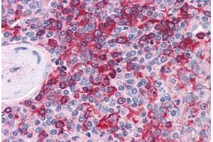 Human Spleen: Formalin-Fixed, Paraffin-Embedded (FFPE)