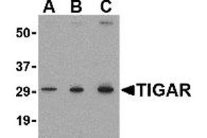 Western Blotting (WB) image for anti-TP53 induced glycolysis regulatory phosphatase (TIGAR) (Middle Region 2) antibody (ABIN1031205) (TIGAR anticorps  (Middle Region 2))