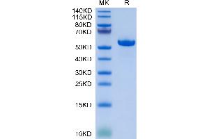Biotinylated Human HLA-G Complex on Tris-Bis PAGE under reduced condition. (HLAG Protein (Monomer) (Biotin,HLA-G))