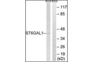 Western blot analysis of extracts from RAW264. (ST6GAL1 anticorps  (Internal Region))
