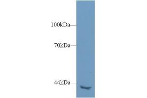 Detection of PLCh2 in Mouse Kidney lysate using Polyclonal Antibody to Phospholipase C Eta 2 (PLCh2)