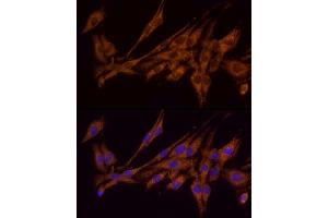 Immunofluorescence analysis of PC-12 cells using  Rabbit pAb (ABIN6129864, ABIN6136458, ABIN6136459 and ABIN6222564) at dilution of 1:100 (40x lens).