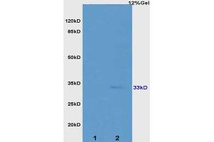 L1 rat kidney lysates L2 rat colon lysates probed with Anti ATP1b2/Na+K+ATPase Polyclonal Antibody, Unconjugated (ABIN738426) at 1:200 overnight at 4 °C.
