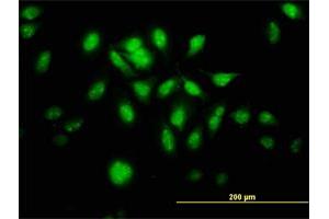 Immunofluorescence of monoclonal antibody to MTA1 on HeLa cell.