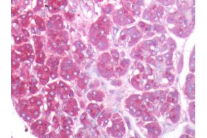 Human Pancreas: Formalin-Fixed, Paraffin-Embedded (FFPE)