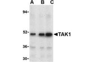 Western blot analysis of TAK1 in Rat thymus cell lysate with this product at (A) 1, (B) 2, and (C) 4 μg/ml.