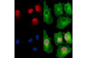 ABIN7095262 and ABIN7099319 staining  cells by IF/ICC. (ZFR anticorps)
