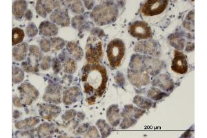 Immunoperoxidase of monoclonal antibody to MVK on formalin-fixed paraffin-embedded human salivary gland. (MVK anticorps  (AA 297-396))