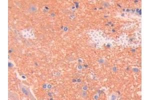 Detection of SPTAN1 in Rat Spinal cord Tissue using Polyclonal Antibody to Alpha-Fodrin (SPTAN1)