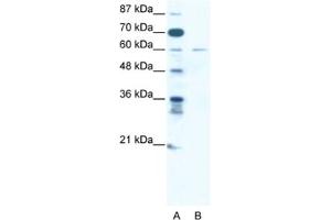 Western Blotting (WB) image for anti-Zinc Finger Protein 92 (ZNF92) antibody (ABIN2461312) (ZNF92 anticorps)