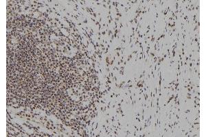 ABIN6279633 at 1/100 staining Human gastric tissue by IHC-P. (NOL9 anticorps  (Internal Region))