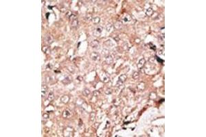 Image no. 2 for anti-Lysine (K)-Specific Demethylase 1A (KDM1A) (C-Term) antibody (ABIN356730) (LSD1 anticorps  (C-Term))