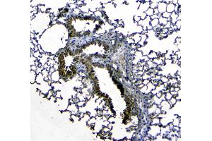 IHC analysis of Uteroglobin using anti-Uteroglobin antibody .