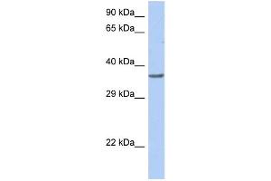 WB Suggested Anti-TFDP1 Antibody Titration:  0. (DP1 anticorps  (Middle Region))