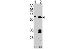 Western blot analysis of MDM2 (arrow) using MDM2 polyclonal antibody . (MDM2 anticorps  (C-Term))