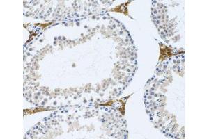 Immunohistochemistry of paraffin-embedded Mouse testis using FMOD Polyclonal Antibody at dilution of 1:100 (20x lens). (Fibromodulin anticorps)