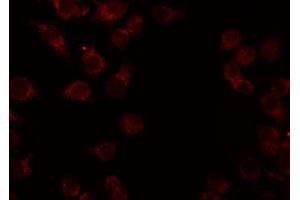 ABIN6276942 staining HeLa by IF/ICC.