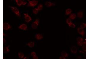 ABIN6276942 staining HeLa by IF/ICC. (CADM1 anticorps  (Internal Region))
