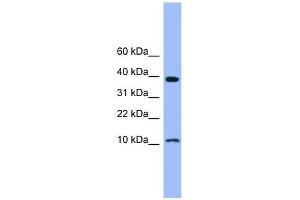 WB Suggested Anti-CSTB Antibody Titration: 0.