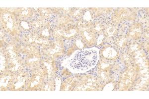 Detection of Tie1 in Human Kidney Tissue using Polyclonal Antibody to Tyrosine Kinase With Immunoglobulin Like And EGF Like Domains Protein 1 (Tie1) (TIE1 anticorps  (AA 701-898))
