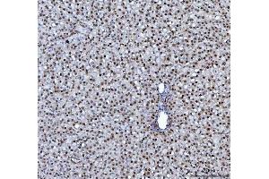 IHC analysis of hnRNP L/HNRNPL using anti-hnRNP L/HNRNPL antibody (ABIN7600130). (HNRNPL anticorps  (AA 152-569))