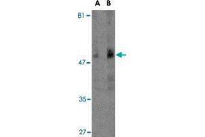 Western blot analysis of TBC1D10C in human spleen tissue lysate with TBC1D10C polyclonal antibody  at (A) 1 and (B) 2 ug/mL . (Carabin anticorps  (N-Term))