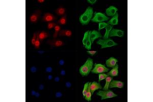 Phospho-4E-BP1 (Thr37/Thr46) Antibody staining Hela cells(heat shock treatment) by IF/ICC.