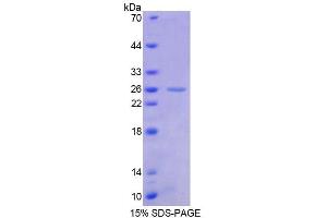 SDS-PAGE analysis of Human FLI1 Protein.