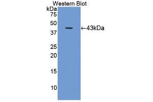 Western blot analysis of the recombinant protein. (C8B anticorps  (AA 161-503))