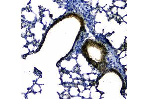 IHC analysis of Uteroglobin using anti-Uteroglobin antibody .