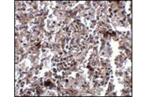 Immunohistochemistry of KCTD15 in human spleen tissue with this product at 2. (KCTD15 anticorps  (C-Term))