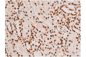ABIN6267604 at 1/200 staining Human kidney tissue sections by IHC-P.