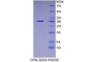 SDS-PAGE (SDS) image for Nucleoporin 133kDa (NUP133) (AA 36-240) protein (His tag) (ABIN1879631) (NUP133 Protein (AA 36-240) (His tag))
