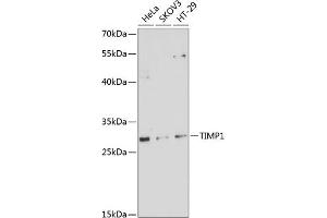 Western blot analysis of extracts of various cell lines, using TIMP1 antibody (ABIN6128284, ABIN6149176, ABIN6149177 and ABIN6218052) at 1:1000 dilution. (TIMP1 anticorps  (AA 24-207))