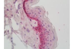 Human Skin: Formalin-Fixed, Paraffin-Embedded (FFPE).