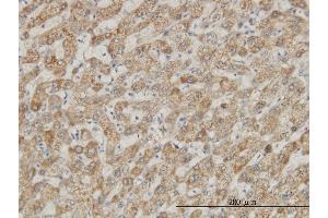 anti-DEAD (Asp-Glu-Ala-Asp) Box Polypeptide 56 (DDX56) (AA 450-547) antibody