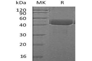 Western Blotting (WB) image for Cathepsin E (CTSE) (AA 60-397) protein (His tag) (ABIN7320713)