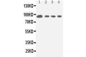 Anti-STAT5a antibody, Western blotting Lane 1: HELA Cell Lysate Lane 2: COLO320 Cell Lysate Lane 3: JURKAT Cell Lysate Lane 4: CEM Cell Lysate (STAT5A anticorps  (C-Term))