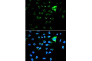 Immunofluorescence analysis of MCF7 cell using CDKN1A antibody. (p21 anticorps  (AA 43-142))