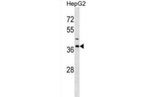 Western Blotting (WB) image for anti-Immunoglobulin (CD79A) Binding Protein 1 (IGBP1) antibody (ABIN2998604) (IGBP1 anticorps)