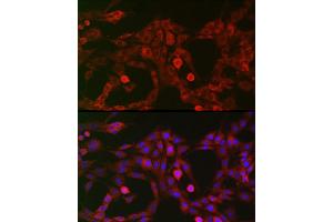 Immunofluorescence analysis of PC-12 cells using LRP5 Rabbit pAb (ABIN1513164, ABIN3020644, ABIN3020646 and ABIN6213630) at dilution of 1:200 (40x lens).