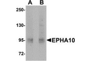 Western Blotting (WB) image for anti-EPH Receptor A10 (EPHA10) (N-Term) antibody (ABIN1031373) (EPH Receptor A10 anticorps  (N-Term))