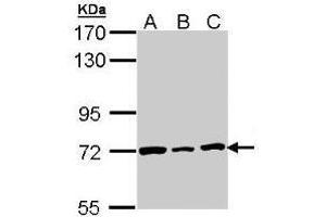 Western Blot: Lamin B2 antibody staining of H1299 (A), Hela (B), HepG2 (C) whole cell lysates (30 µg) at 1/3000 dilution, 7. (Lamin B2 anticorps  (AA 221-460))