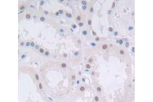 IHC-P analysis of Human Tissue, with DAB staining. (H2AFX anticorps  (AA 2-143))