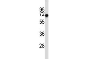 CD5 antibody western blot analysis in ZR-75-1 lysate.