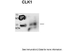 Sample type: human microvascular endothelial cells (25ug)Primary Dilution: 1:1000Secondary Antibody: Goat anti-Rabbit-HRPSecondary Dilution: 1:5000Image Submitted by: Andreas Eisenreich Charite Universitatsmedizin Berlin