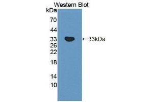 Detection of Recombinant PLCb2, Mouse using Polyclonal Antibody to Phospholipase C Beta 2 (PLCb2)