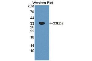 Detection of Recombinant PLCb2, Mouse using Polyclonal Antibody to Phospholipase C Beta 2 (PLCb2) (Phospholipase C beta 2 anticorps  (AA 1-250))