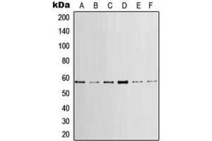 Western blot analysis of LCK expression in HeLa (A), MCF7 (B), mouse brain (C), mouse heart (D), rat brain (E), rat heart (F) whole cell lysates. (LCK anticorps  (Center))